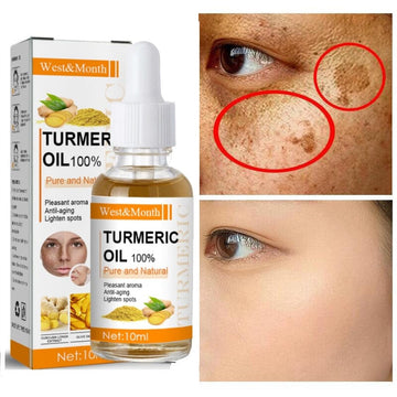 Turmeric Whitening Serum Dark Spot Remover